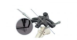 PEEK Femoral and Tibial Gamma Intramedullary Nail Aiming Instrument